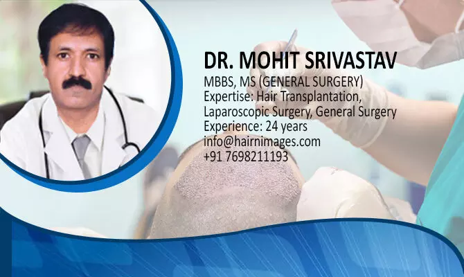 Surats Dr. Mohit Srivastava explains why FUE Hair Transplant is used to resolve baldness and receding hairline issues