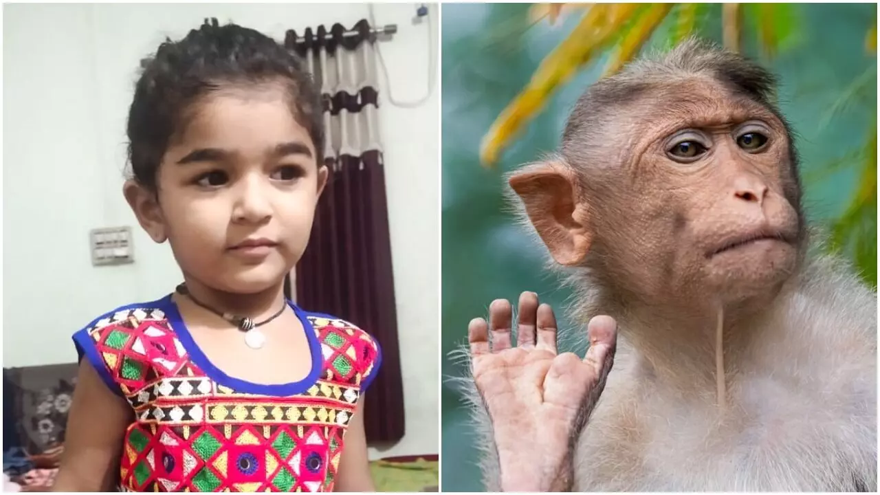 Three and half year old girl recieved 60 stitches after bitten by monkey in Ajod village near Vadodara