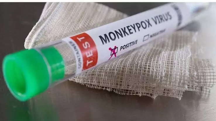 Monkeypox: Indian company develops RT-PCR kit to test for virus