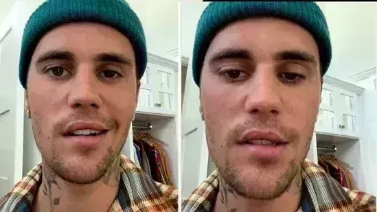 Justin Bieber says right side of his face is paralysed after virus attack, calls it pretty serious condition