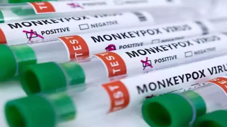 Kerala reports fifth monkeypox case in 30-year-old UAE returnee