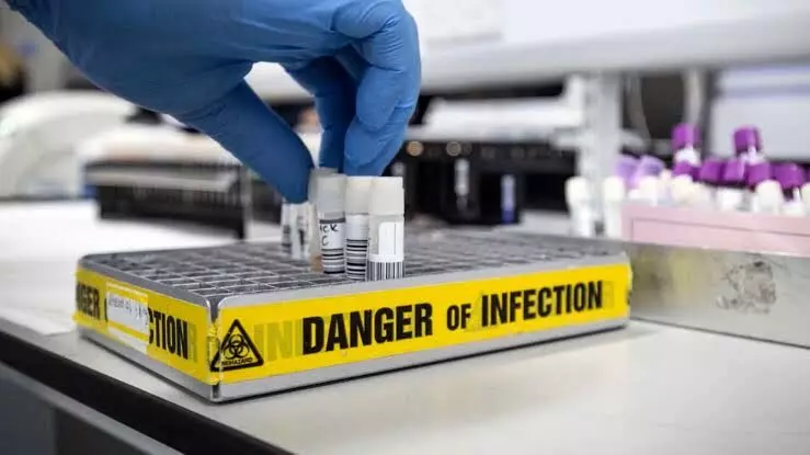 US health body warns of deadly Marburg Virus after outbreak in Africa