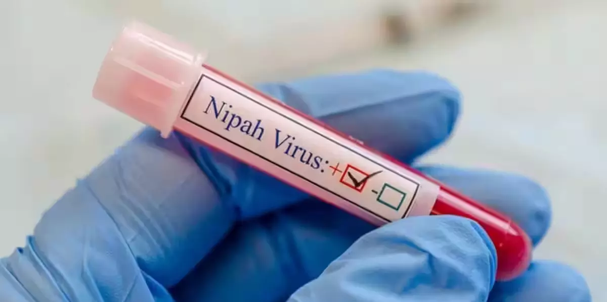 Nipah virus can cause severe infection in children, experts suggest cautionary measures