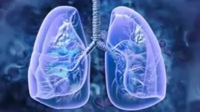 Study: Indians suffering more from post-covid lung damage