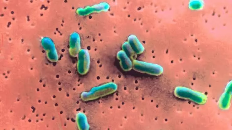 Surge in rare bacterial disease in the US worrying health experts