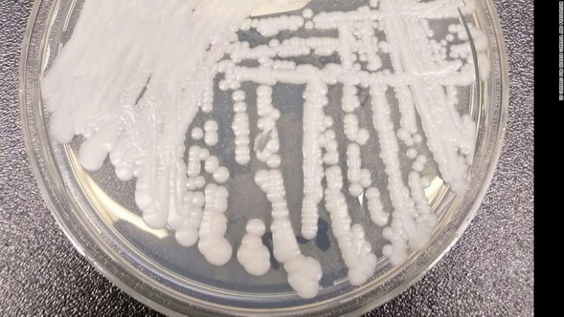 First drug-resistant fungal infections identified in US