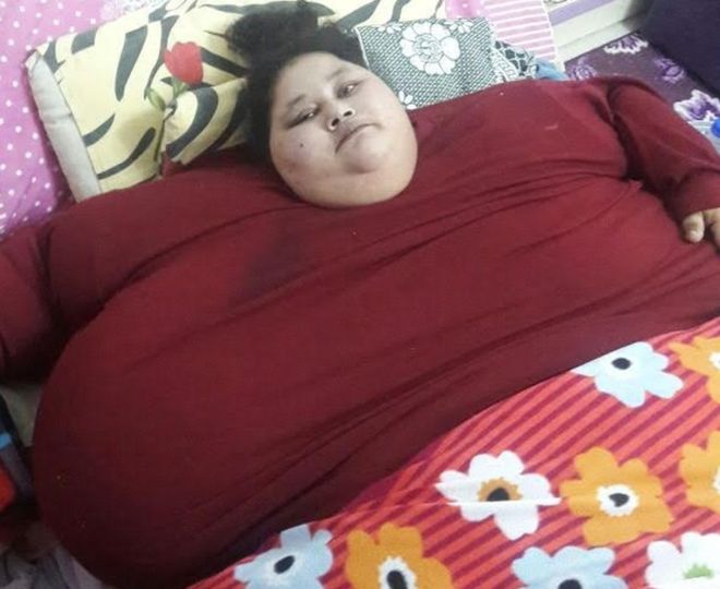 500 kg Egyptian woman to get free weight loss treatment