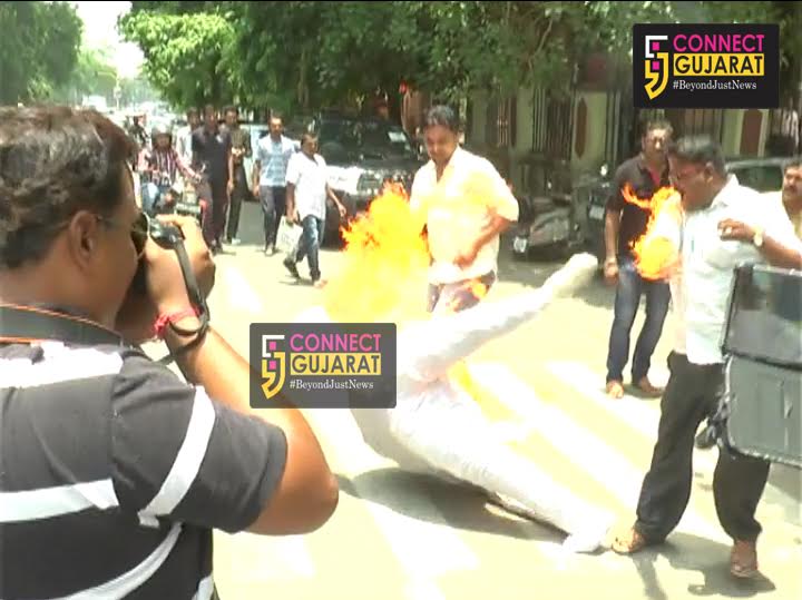 Congress protestor burns himself in Vadodara