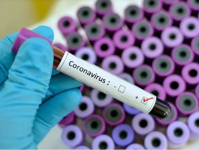 55 year old male tested positive of Coronavirus taking the total number of patients to eight in Vadodara