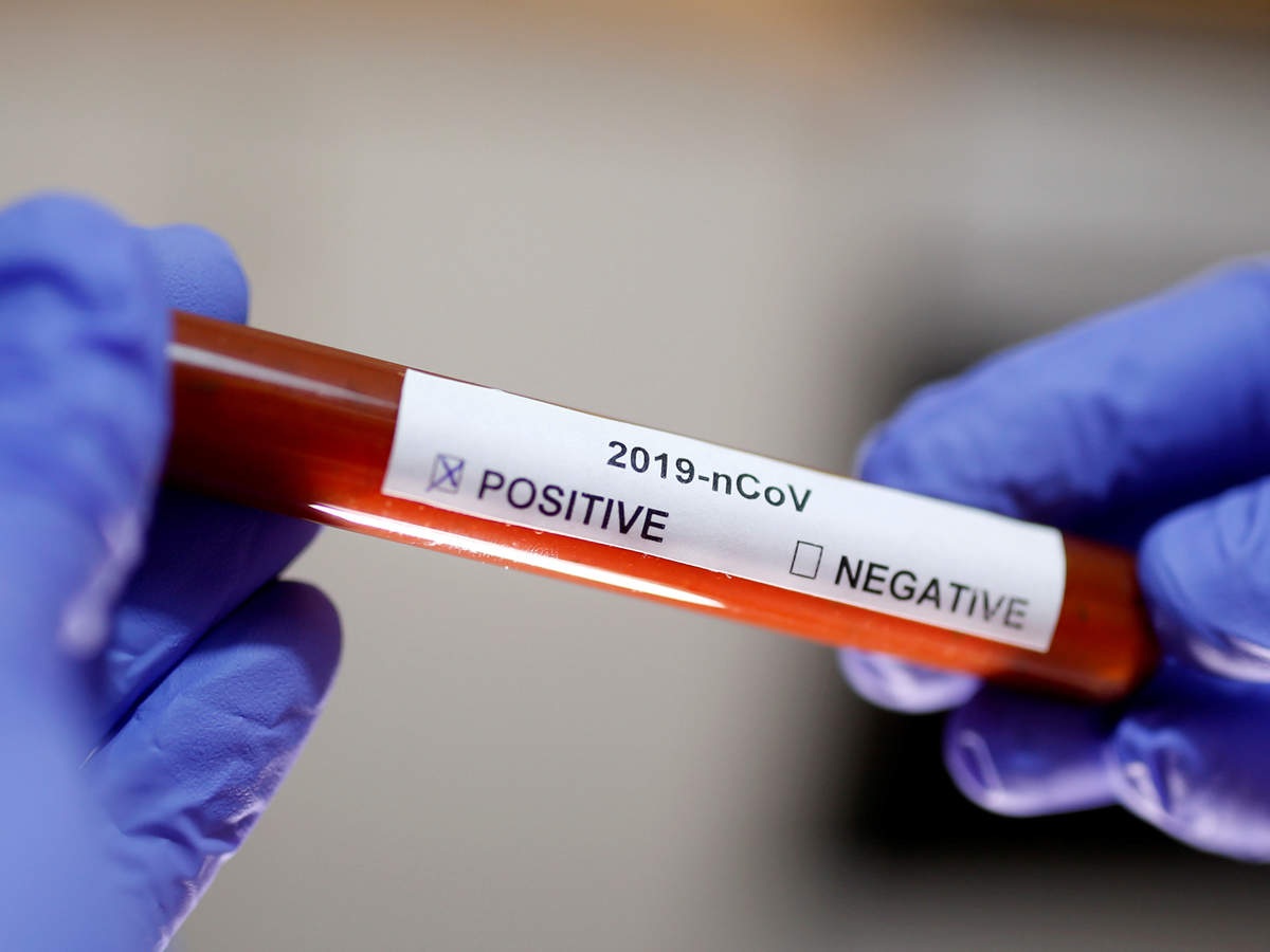 Three new cases of Coronavirus positive registered in Vadodara