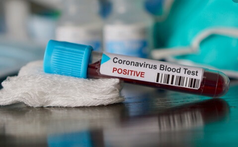 470 samples negative of Coronavirus out of 744 in Vadodara