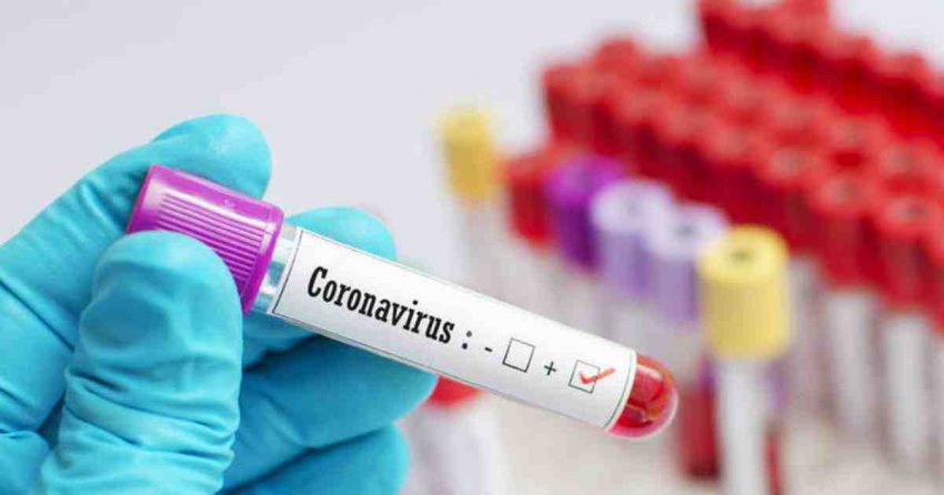 Covid 19 cases reached 20196 in Vadodara after 103 new cases on Sunday