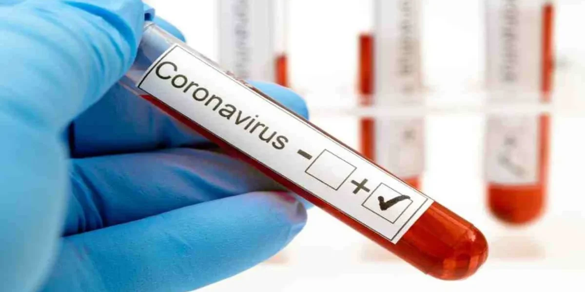 Covid 19 cases reached 23934 in Vadodara after 42 new cases on Wednesday