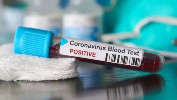 Covid 19 cases reached 24524 in Vadodara after 42 new cases on Wednesday