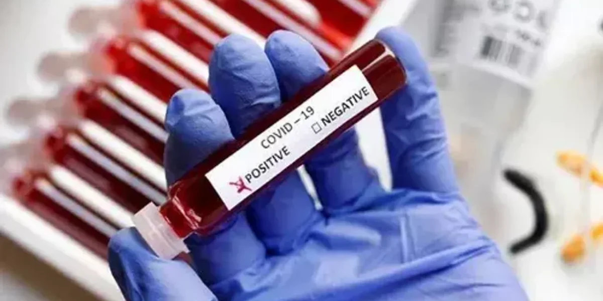 Covid 19 cases reached 71910 in Vadodara after 3 new cases on Monday