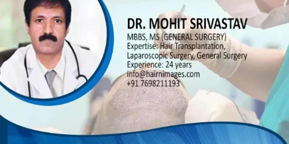 Surat’s Dr. Mohit Srivastava explains why FUE Hair Transplant is used to resolve baldness and receding hairline issues