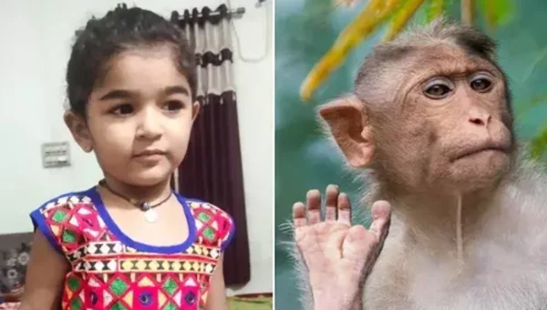 Three and half year old girl recieved 60 stitches after bitten by monkey in Ajod village near Vadodara