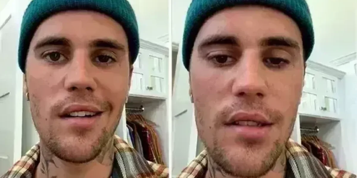 Justin Bieber says right side of his face is paralysed after virus attack, calls it ‘pretty serious’ condition