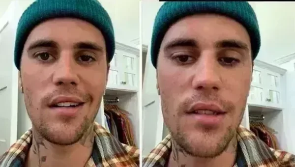 Justin Bieber says right side of his face is paralysed after virus attack, calls it ‘pretty serious’ condition