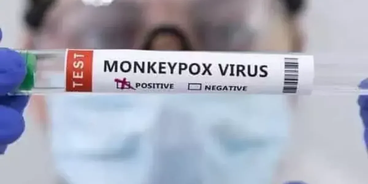 Man tests positive for monkeypox, COVID and HIV at the same time