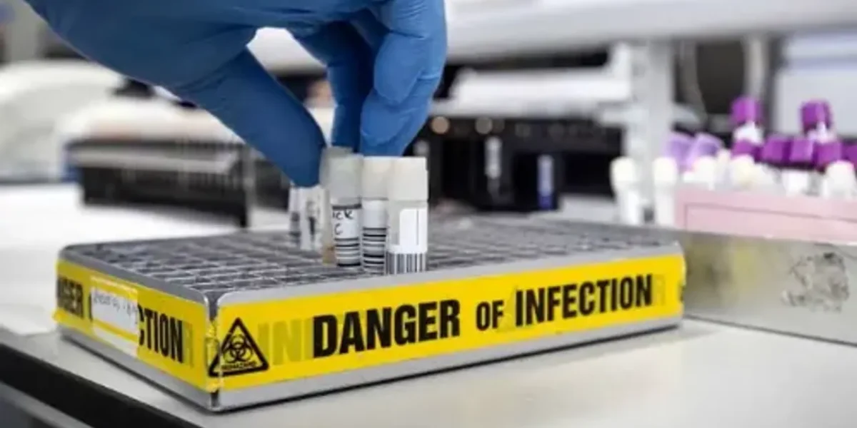 US health body warns of deadly Marburg Virus after outbreak in Africa