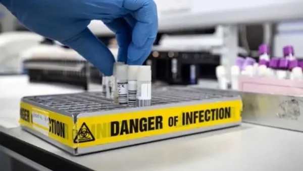 US health body warns of deadly Marburg Virus after outbreak in Africa