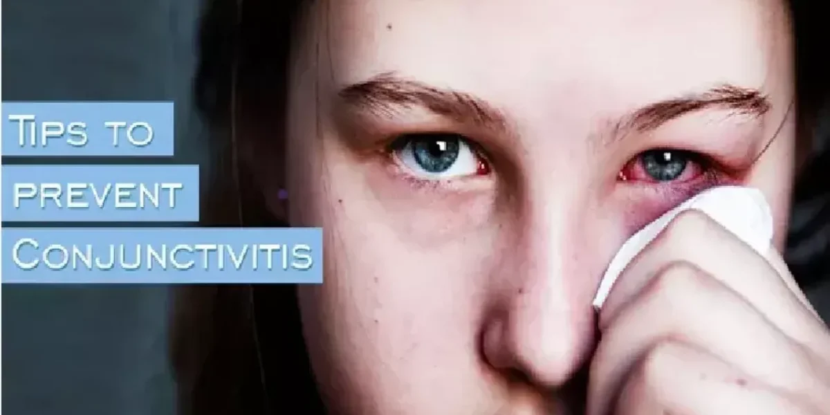 7 Easy Ways To Prevent ‘Conjunctivitis’