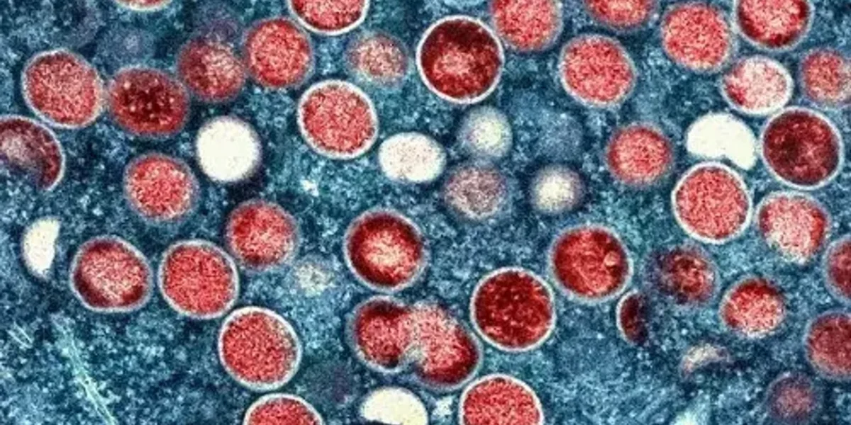 China Mpox cases surge as virus spreads to more parts of country