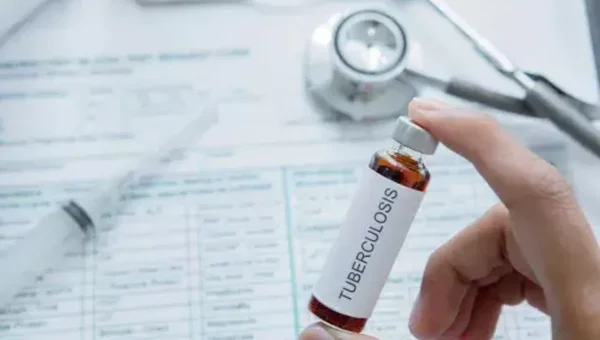 Health Ministry rejects reports of tuberculosis medicine shortages