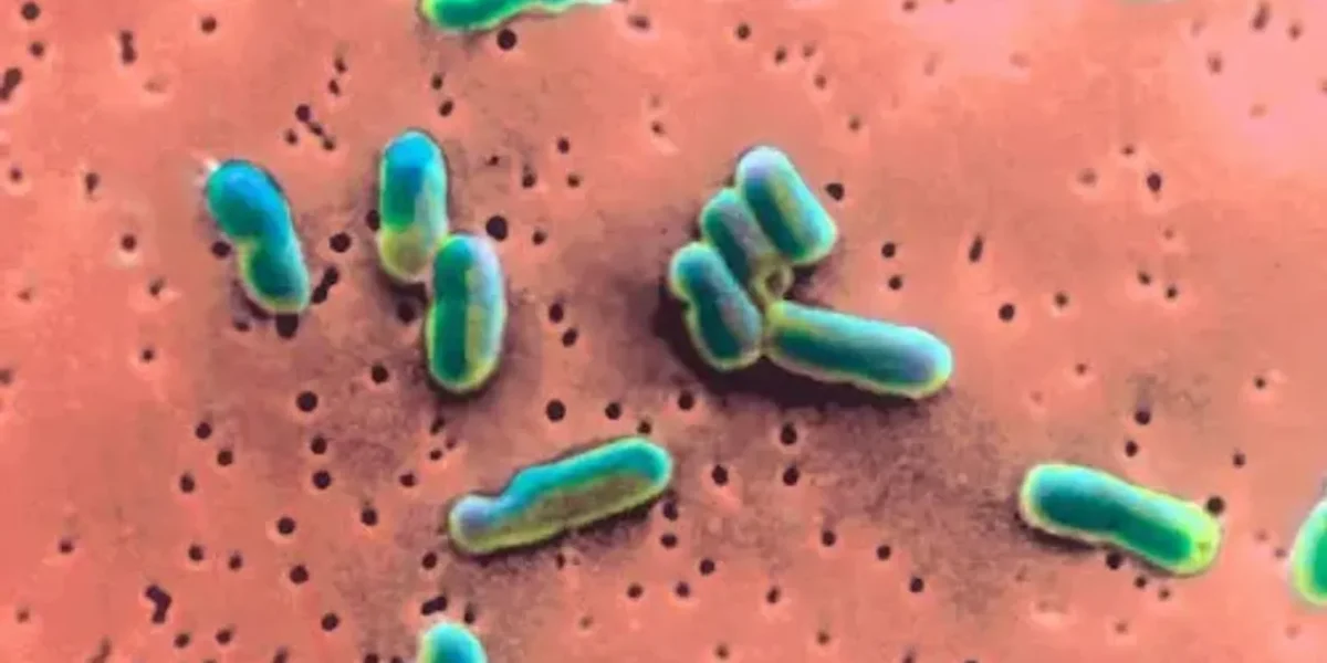 Surge in rare bacterial disease in the US worrying health experts