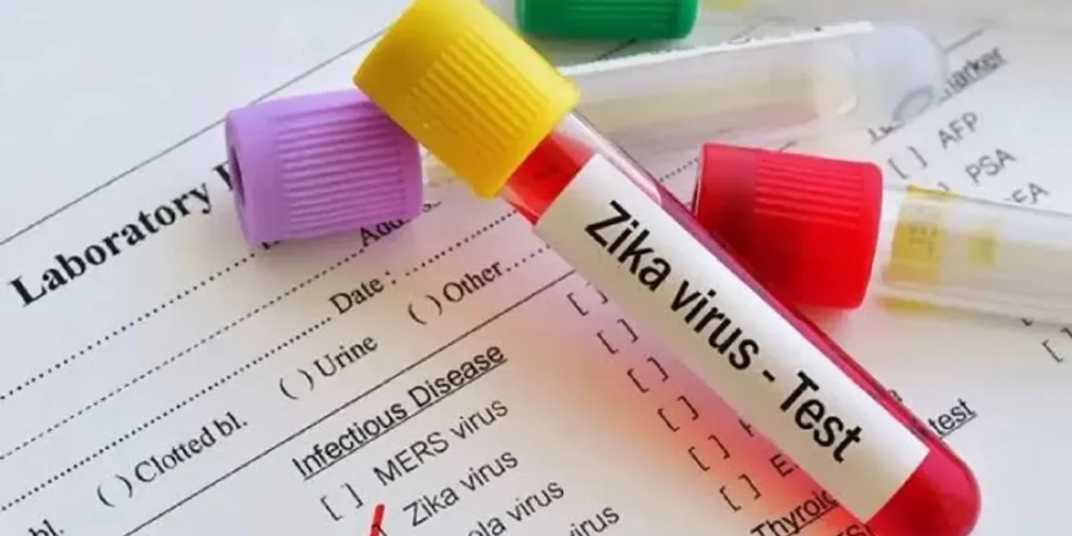 Pune: 66 Cases of Zika Virus infection found since June