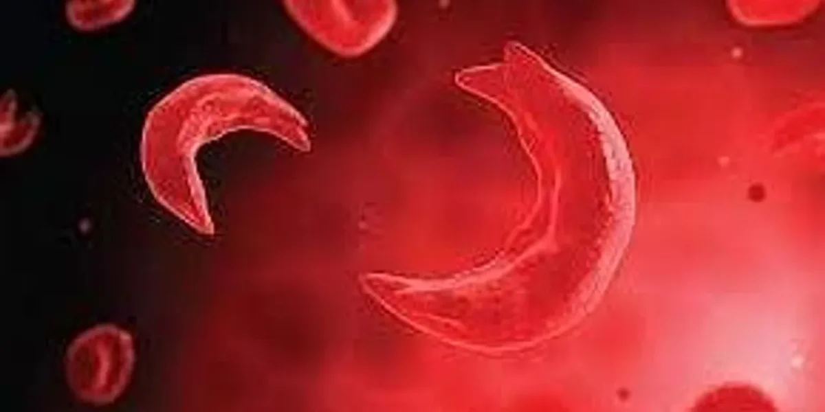 Tribal Rajasthan faces Sickle Cell surge 10,000+ cases