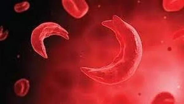 Tribal Rajasthan faces Sickle Cell surge 10,000+ cases