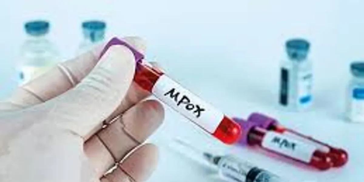 UK health authorities probe unexplained mpox infection