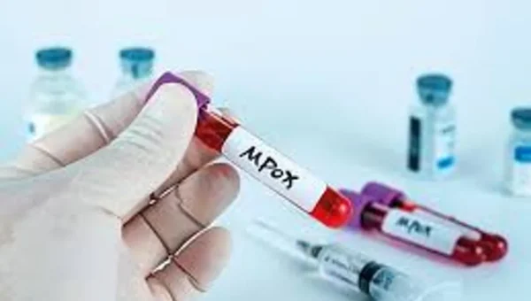 UK health authorities probe unexplained mpox infection