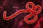 Ebola Outbreak in Congo Raises Global Alarm